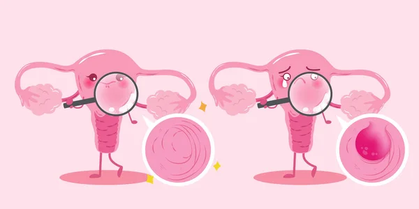 Schattige cartoon baarmoeder — Stockvector