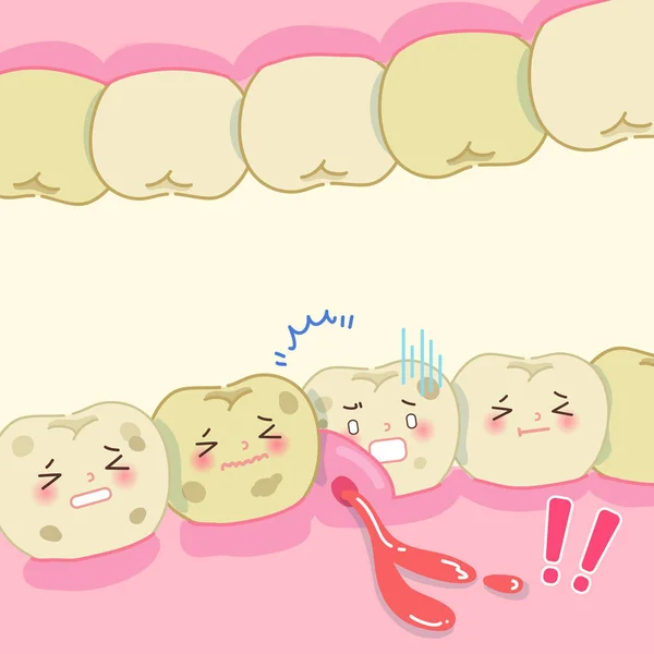 Cartoon tand förfall problem — Stock vektor