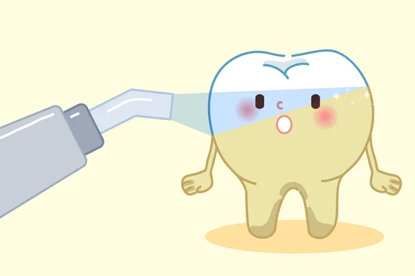 Dientes láser con concepto de blanqueamiento — Vector de stock