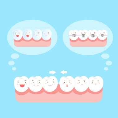 tooth wear different brace clipart