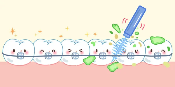 Corsé de desgaste dental con cepillo — Vector de stock