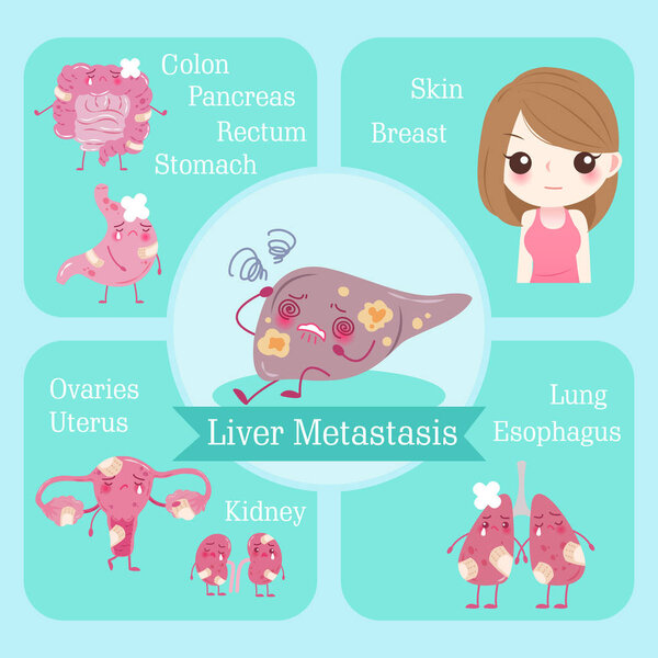cartoon liver metastasis