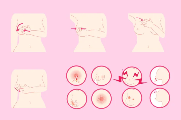 妇女患乳腺癌 — 图库矢量图片