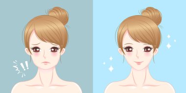 kadın Çene Cerrahisi