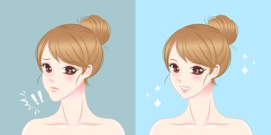 kadın Çene Cerrahisi