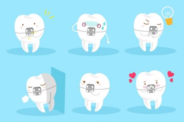 Diş giyim diş telleri