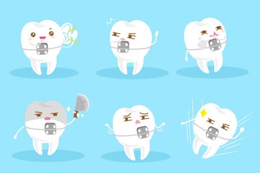 Diş giyim diş telleri