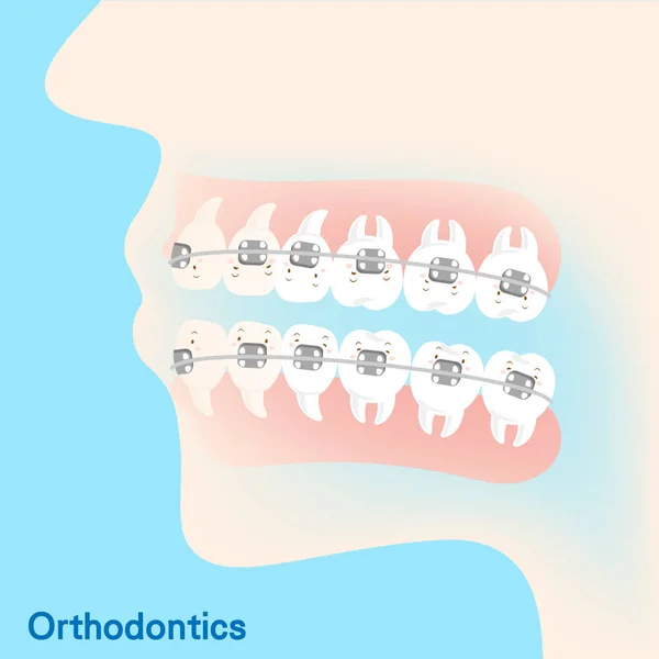 Diş küme ayracı kavramı — Stok Vektör