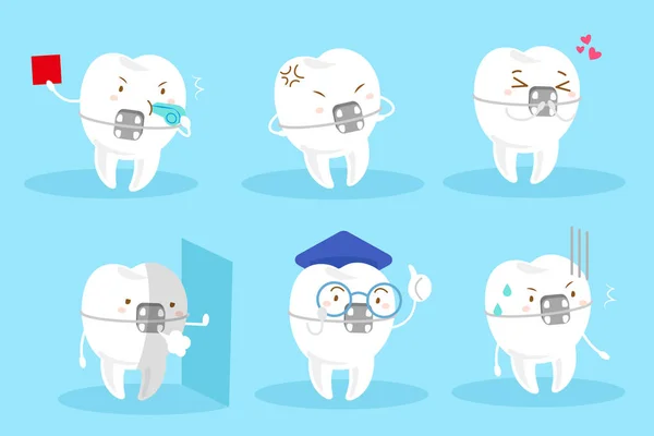Tooth wear braces — Stock Vector