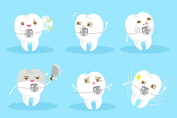 Зуб носити брекети — стоковий вектор