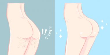 kalça plastik cerrahi kavramı ile