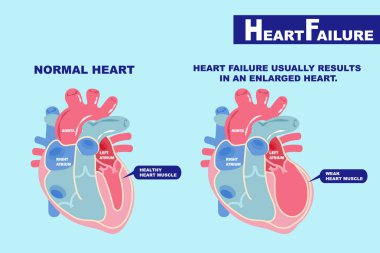 cartoon heart failure concept on the green background clipart