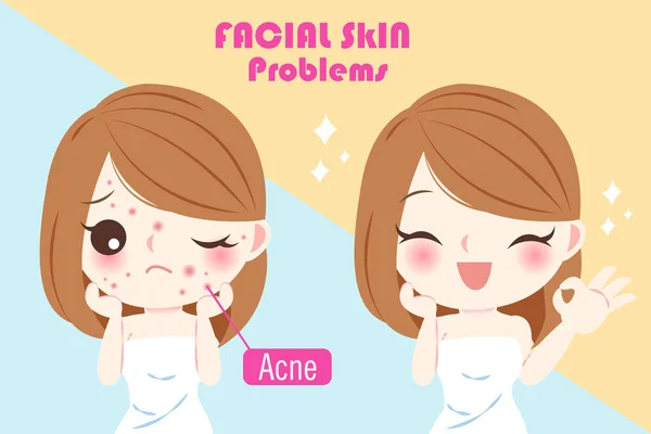 Mulher com problema de acne — Vetor de Stock