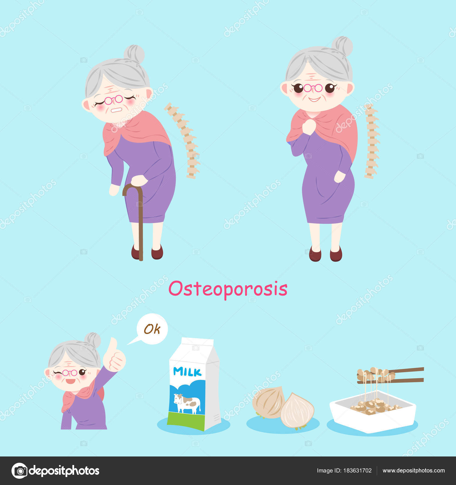 Old woman with osteoporosis Stock Vector Image by ©estherqueen999 #183631702 Old woman with osteoporosis Stock Vector Image by ©estherqueen999 #183631702