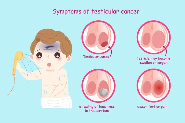 Homme atteint d'un cancer des testicules — Image vectorielle