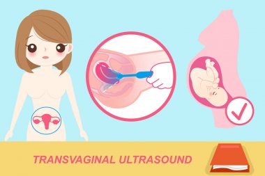 woman with transvaginal clipart