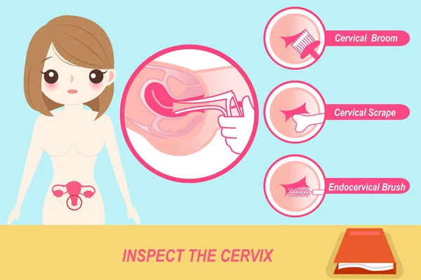 Donna con ispezionare la cervice — Vettoriale Stock