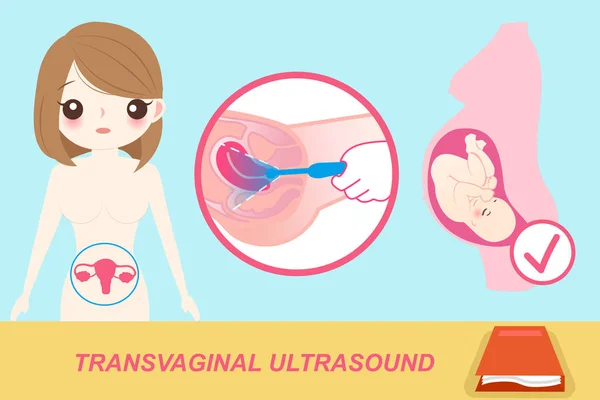 Mujer con transvaginal — Vector de stock