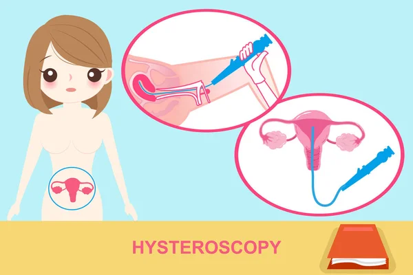 Frau mit Hysteroskopie — Stockvektor