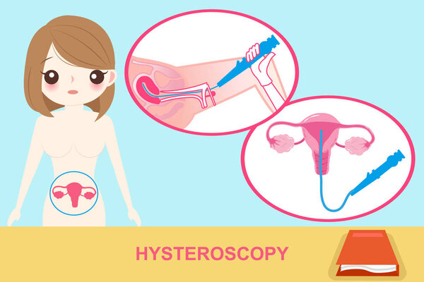 woman with hysteroscopy