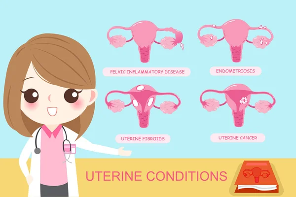 Concepto de condiciones uterinas — Archivo Imágenes Vectoriales