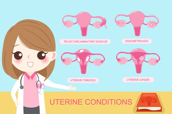 uterine conditions concept
