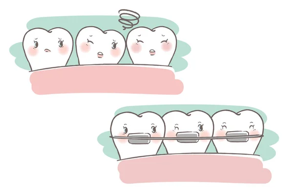 Zub s konceptem složená závorka — Stockový vektor