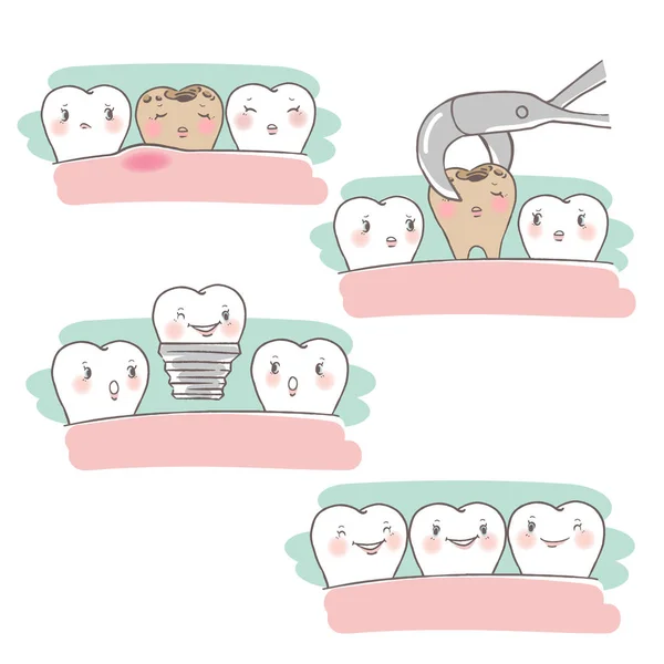 Зуб імплантату — стоковий вектор