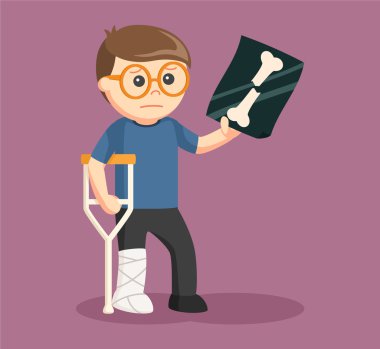 adam bacak yaralanma ve onun xray gösterilen