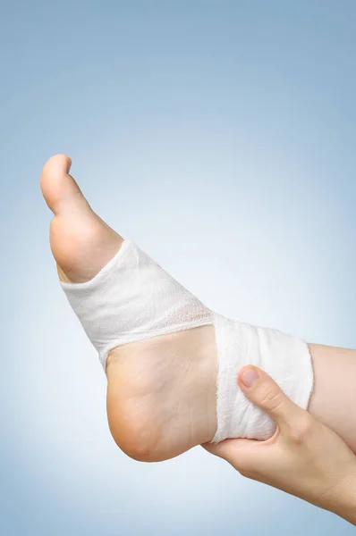 Verletzter Fuß mit Verband — Stockfoto