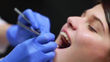 Diş hekimi muayene hastalar diş, yakın çekim