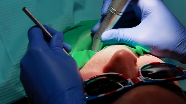Ο οδοντίατρος και η νοσοκόμα επισκευή ένα δόντι ενός ασθενή άνδρα. Η χρήση του bormashenko τρυπάνι δόντια και κατάργησης τερηδόνα και σφράγιση. — Αρχείο Βίντεο
