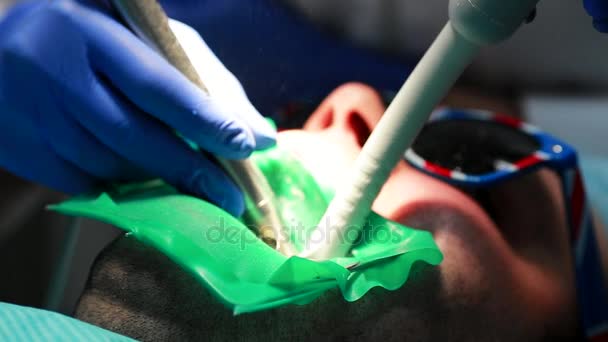 一名妇女举行牙医钻病人牙齿和围栏的牙齿残留在牙医办公室. — 图库视频影像