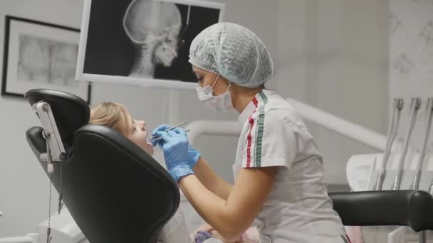 De tandarts inspecteert de accolades een klein meisje en controleert de tanden op de aanwezigheid van cariës. Het Bureau van de tandartsen. — Stockvideo