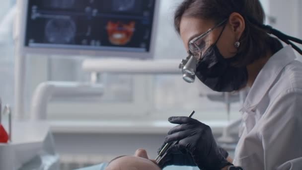 Close-up van een tandarts in verrekijker die een patiënt in een stoel behandelt op de achtergrond van het beeld op het scherm. Professionele tandarts — Stockvideo