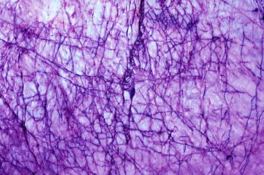 Arka plan resmi bir mor taş.