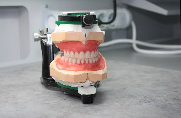 Modelos de cera de prótesis dentales en articulador Fotos de stock