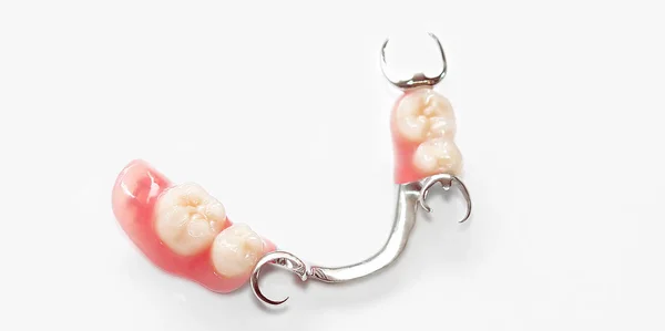 Chrome Cobalt Removable Partial Denture — Stock Photo, Image