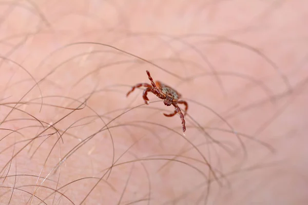 Danger of tick bite. Mite on the skin