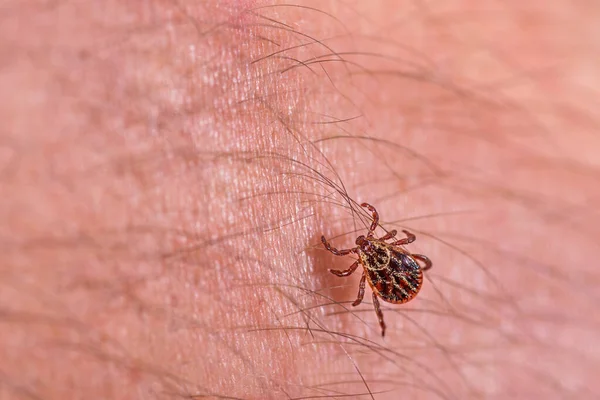 Mite Piel Peligro Picadura Garrapata —  Fotos de Stock