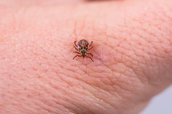 Mite Kůži Nebezpečí Kousnutí Klíštěte — Stock fotografie