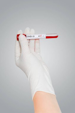 Covid-19 için kan testi pozitif. Tıbbi elde. Beyazlara yakın.
