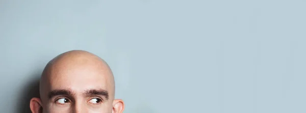 Emotional portrait of surprised bald man. — Stock Photo, Image