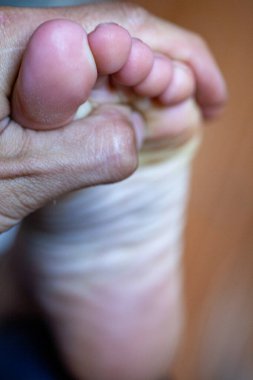 Genç kızın parmakları sağlıklı ve güzel. Tıbbi malzemeler ve merhemler için iyi hazırlanmış bir kavram, ayakların görüntüsü. İfadeler ve reklamlar için alanı olan bacakların resmi.