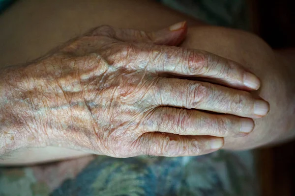 The process of aging of human skin - wrinkled hands of a very old man who lived 90-100 years with dry skin covered with wrinkles and spots