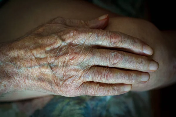 Processo Envelhecimento Pele Humana Mãos Enrugadas Homem Muito Velho Que — Fotografia de Stock