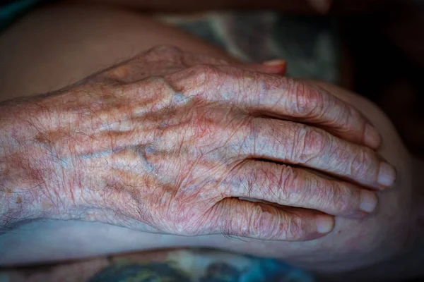 Processus Vieillissement Peau Humaine Les Mains Ridées Homme Très Âgé — Photo