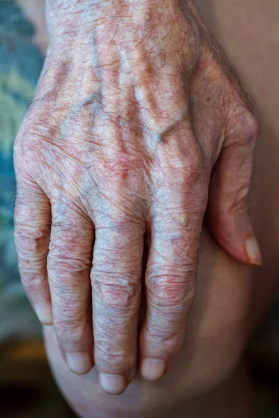 Envelhecimento velha mulher sênior mãos pele enrugada — Fotografia de Stock