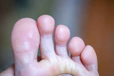 Genç kızın parmakları sağlıklı ve güzel..