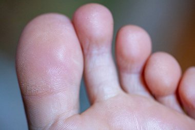 Genç kızın parmakları sağlıklı ve güzel..